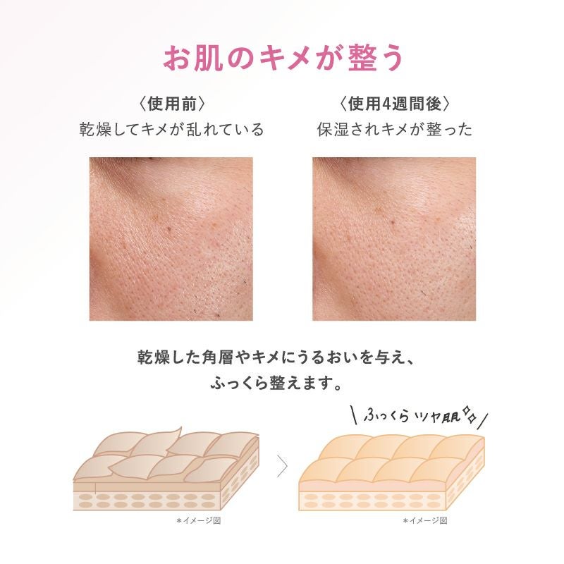 限定】タイムシークレット 薬用デイエッセンスバーム サクララッシュの